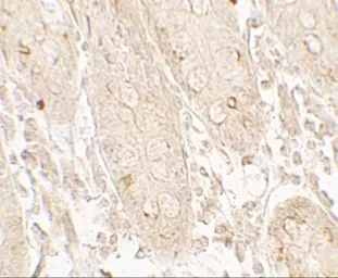 Anti-GRK6 antibody used in IHC (Paraffin sections) (IHC-P). GTX31564