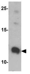 Anti-FKBP12 antibody used in Western Blot (WB). GTX31576