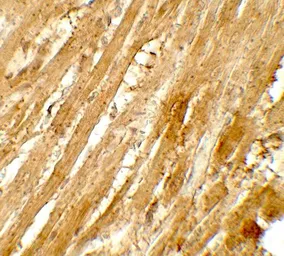 Anti-WAPL antibody used in IHC (Paraffin sections) (IHC-P). GTX31577