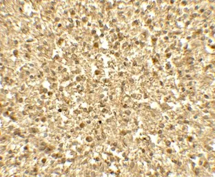 Anti-SREBP1 antibody used in IHC (Paraffin sections) (IHC-P). GTX31579