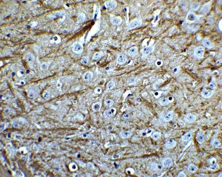 Anti-PINK1 antibody used in IHC (Paraffin sections) (IHC-P). GTX31581