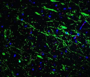 Anti-PINK1 antibody used in IHC (Paraffin sections) (IHC-P). GTX31581