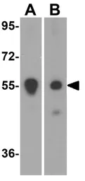 Anti-PINK1 antibody used in Western Blot (WB). GTX31581