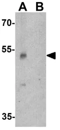 Anti-PINK1 antibody used in Western Blot (WB). GTX31581
