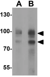 Anti-Neuroligin 2 antibody used in Western Blot (WB). GTX31597