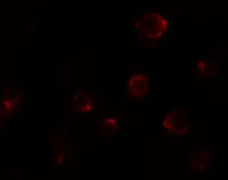 Anti-P2X7 antibody used in Immunocytochemistry/ Immunofluorescence (ICC/IF). GTX31600