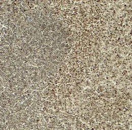 Anti-HES5 antibody used in IHC (Paraffin sections) (IHC-P). GTX31605