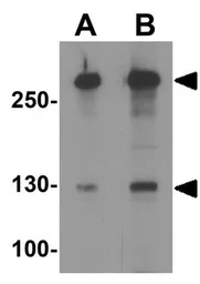 Anti-ARID1A antibody used in Western Blot (WB). GTX31619