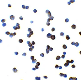 Anti-OATP2 antibody used in Immunocytochemistry/ Immunofluorescence (ICC/IF). GTX31621