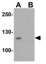 Anti-Golgin 97 antibody used in Western Blot (WB). GTX31624