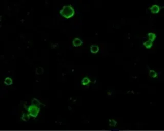 Anti-ADAM17 antibody used in Immunocytochemistry/ Immunofluorescence (ICC/IF). GTX31632