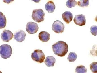 Anti-ADAM17 antibody used in Immunocytochemistry/ Immunofluorescence (ICC/IF). GTX31632