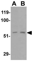Anti-RIP2 antibody used in Western Blot (WB). GTX31647