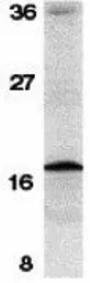 Anti-Survivin antibody used in Western Blot (WB). GTX31653
