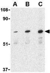 Anti-PAK6 antibody used in Western Blot (WB). GTX31672