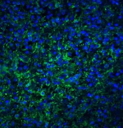 Anti-TLR4 antibody used in IHC (Paraffin sections) (IHC-P). GTX31675