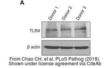 Anti-TLR4 antibody used in Western Blot (WB). GTX31675