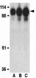 Anti-ACE2 antibody used in Western Blot (WB). GTX31680