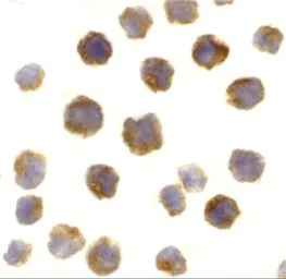 Anti-Bcl-2 antibody used in Immunocytochemistry/ Immunofluorescence (ICC/IF). GTX31687