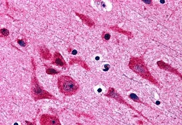 Anti-TAB2 antibody used in IHC (Paraffin sections) (IHC-P). GTX31692