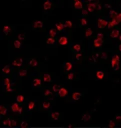Anti-BTK antibody used in Immunocytochemistry/ Immunofluorescence (ICC/IF). GTX31694