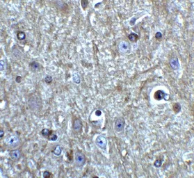 Anti-Beclin 1 antibody used in IHC (Paraffin sections) (IHC-P). GTX31722