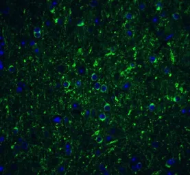 Anti-Beclin 1 antibody used in IHC (Paraffin sections) (IHC-P). GTX31722