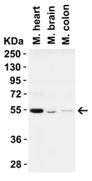 Anti-Beclin 1 antibody used in Western Blot (WB). GTX31722