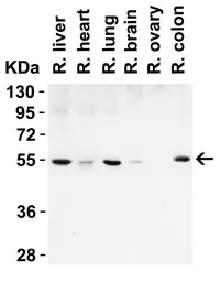 Anti-Beclin 1 antibody used in Western Blot (WB). GTX31722