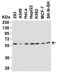 Anti-Beclin 1 antibody used in Western Blot (WB). GTX31722