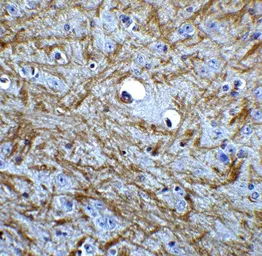 Anti-Bag1 antibody used in IHC (Paraffin sections) (IHC-P). GTX31736