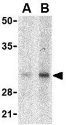 Anti-SLUG antibody used in Western Blot (WB). GTX31748