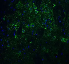 Anti-Nicastrin antibody used in IHC (Paraffin sections) (IHC-P). GTX31752