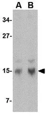 Anti-Stathmin 1 antibody used in Western Blot (WB). GTX31760