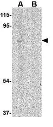 Anti-RAP80 antibody used in Western Blot (WB). GTX31763