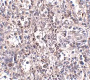 Anti-SR-BI antibody used in IHC (Paraffin sections) (IHC-P). GTX31791