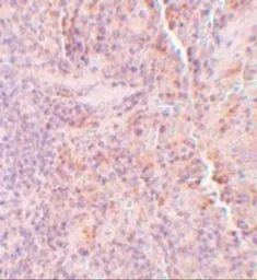 Anti-SQSTM1 / P62 antibody used in IHC (Paraffin sections) (IHC-P). GTX31795