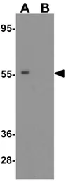 Anti-SQSTM1 / P62 antibody used in Western Blot (WB). GTX31795