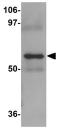 Anti-NABC1 antibody used in Western Blot (WB). GTX31800