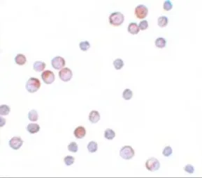 Anti-FOXO4 antibody used in Immunocytochemistry/ Immunofluorescence (ICC/IF). GTX31807