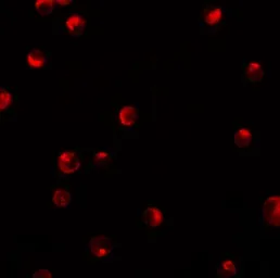 Anti-SRP1 antibody used in Immunocytochemistry/ Immunofluorescence (ICC/IF). GTX31811