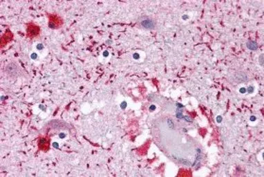 Anti-PIWIL2 antibody used in IHC (Paraffin sections) (IHC-P). GTX31816