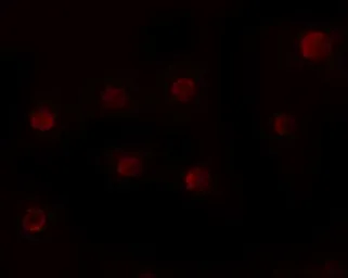 Anti-ZNF198 antibody used in Immunocytochemistry/ Immunofluorescence (ICC/IF). GTX31821