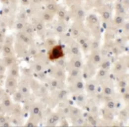 Anti-EI24 antibody used in IHC (Paraffin sections) (IHC-P). GTX31841