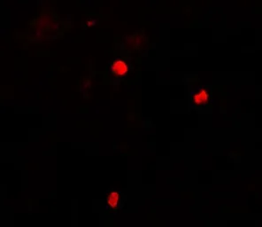 Anti-KEAP1 antibody used in IHC (Paraffin sections) (IHC-P). GTX31864