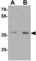 Anti-MECR antibody used in Western Blot (WB). GTX31866