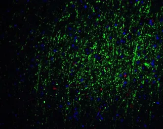 Anti-FOXA2 antibody used in IHC (Paraffin sections) (IHC-P). GTX31875