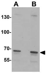 Anti-SLC27A6 antibody used in Western Blot (WB). GTX31878