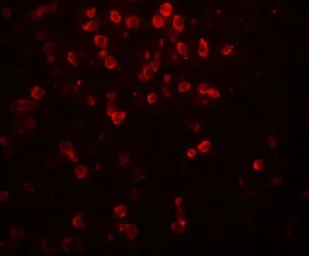 Anti-IL9 antibody used in IHC (Paraffin sections) (IHC-P). GTX31894