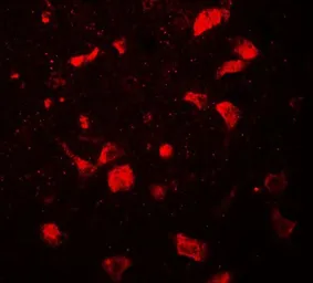 Anti-OLIG1 antibody used in IHC (Paraffin sections) (IHC-P). GTX31916